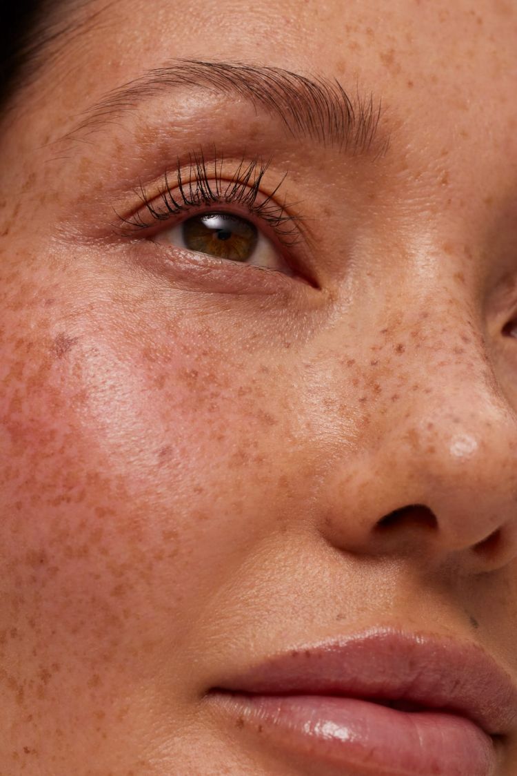 AMPERNA-Skin-Concern-4.jpg