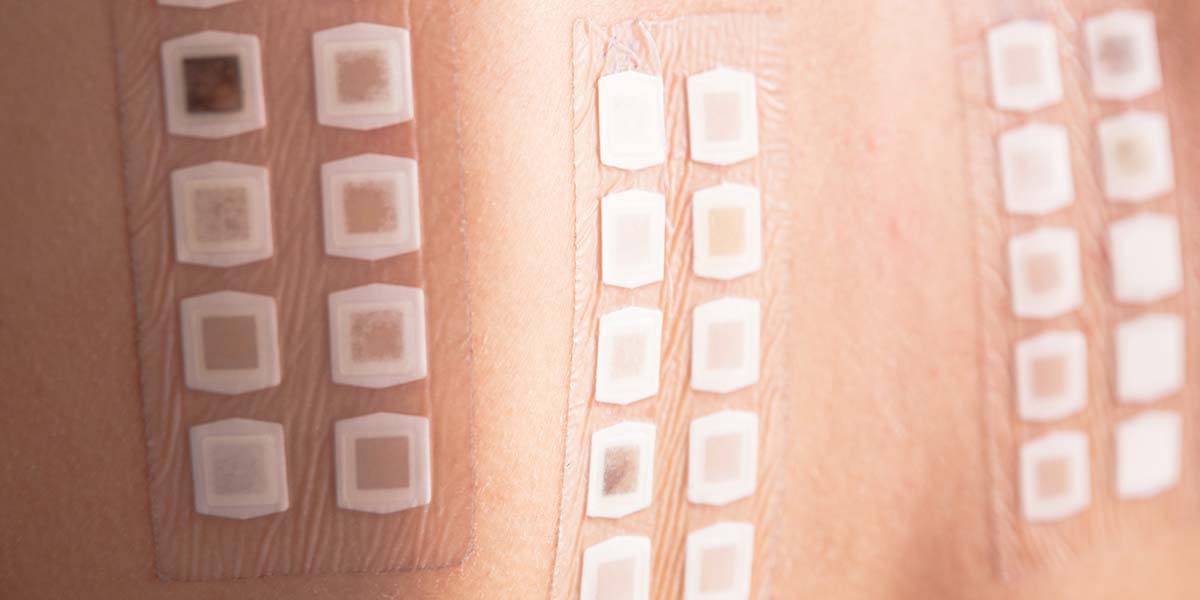 Allergic Reactions Caused by Food or Skincare