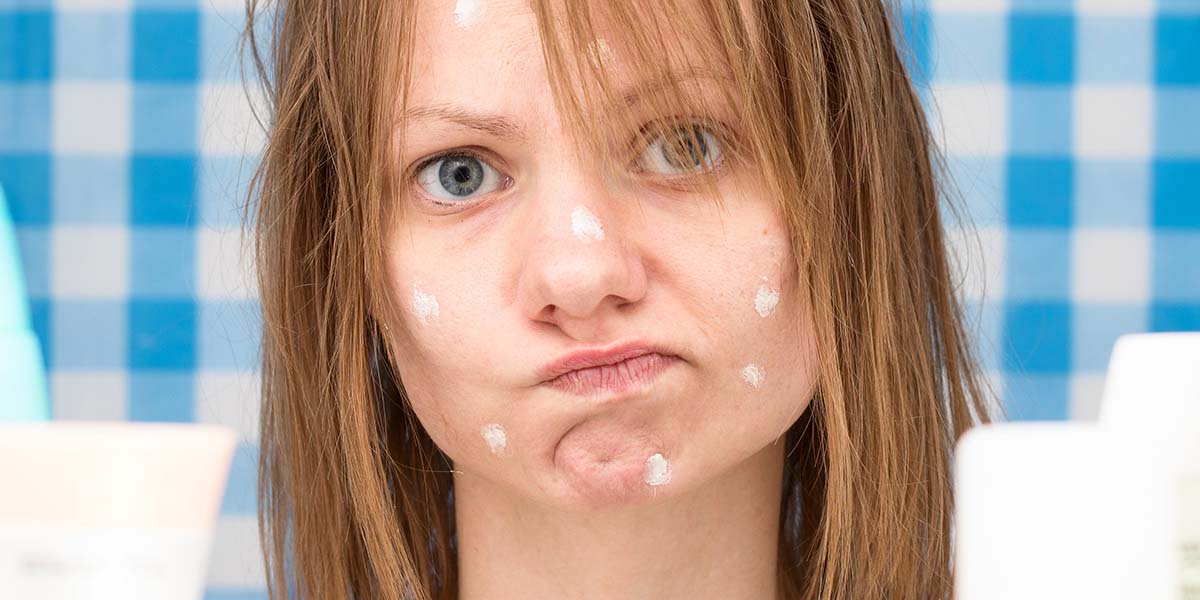 Drying out Pimples: Helpful or Harmful?
