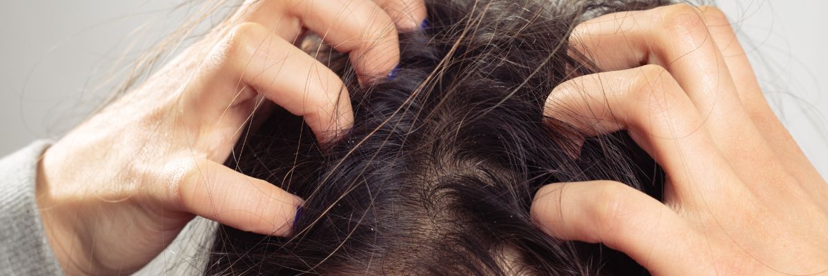 Why Is My Scalp Itchy After Washing My Hair?