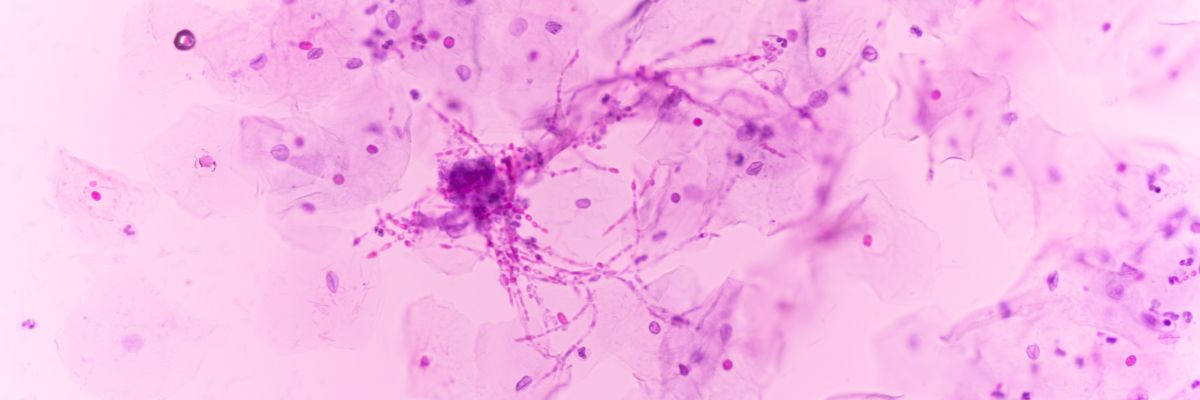 Probiotics, Prebiotics and Postbiotics in Skincare:  What is the Difference?