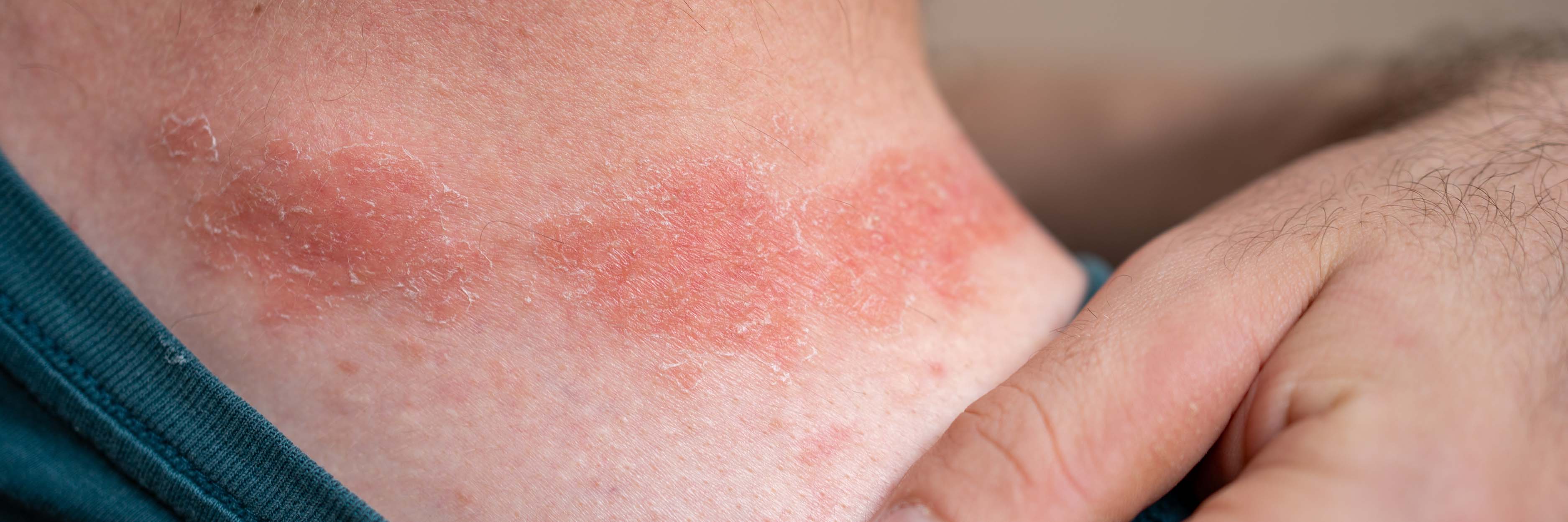 Suffering From Sensitive Skin? Here is How Every Product Adds Up