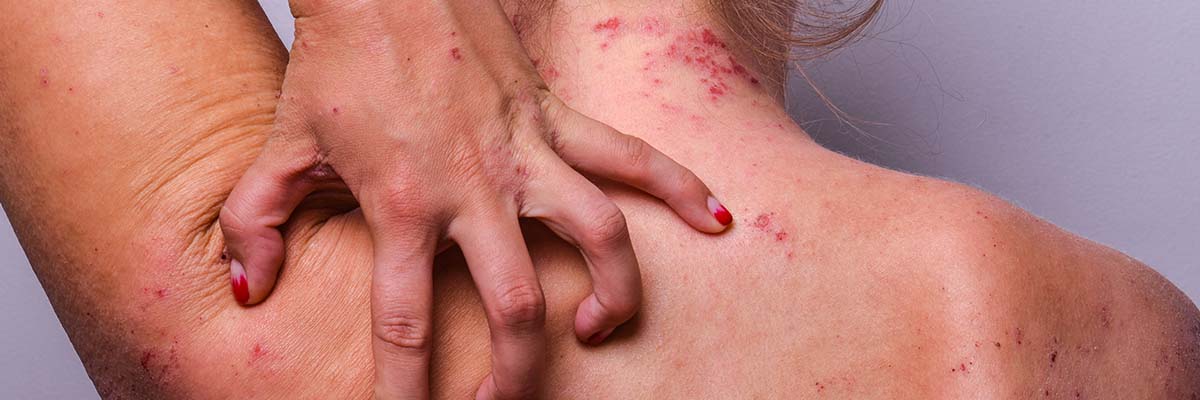 What are Biologics? Things to Consider