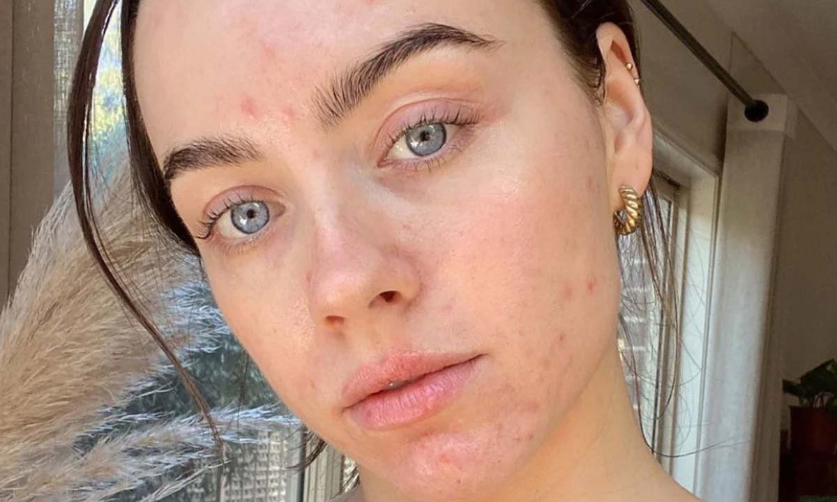 How Skin Positive Are You?