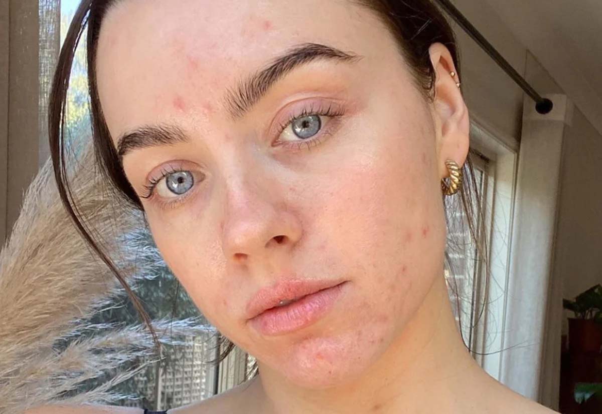 How Skin Positive Are You?