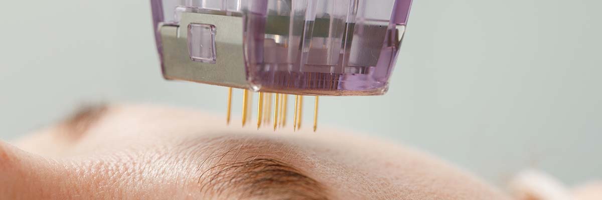Beauty Treatments You Should Avoid If You Have Sensitive Skin
