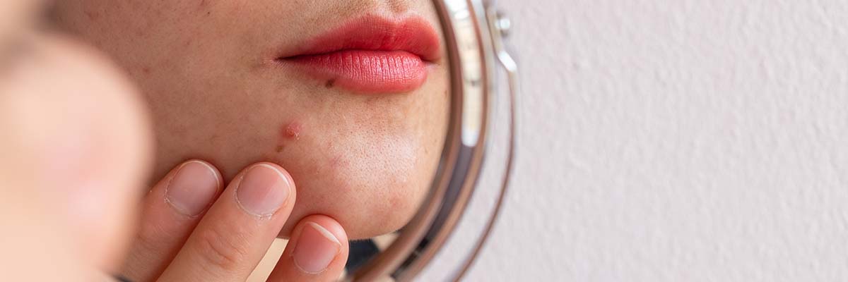 How Your Menstrual Cycle Effects Your Skin