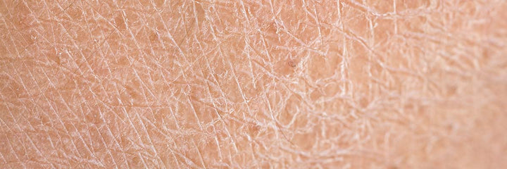 AMPERNA Mature Skin